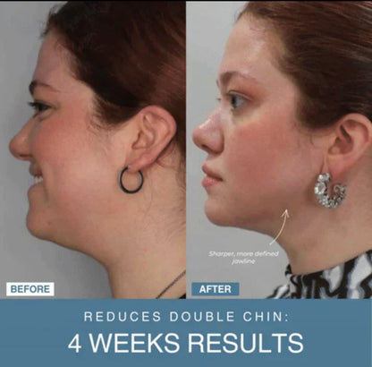 7-in-1 LED Anti-Aging/Wrinkle Apparatus